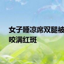 女子睡凉席双腿被螨虫咬满红斑
