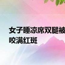 女子睡凉席双腿被螨虫咬满红斑