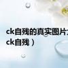 ck自残的真实图片大全（ck自残）