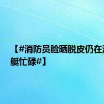 【#消防员脸晒脱皮仍在湖面驾艇忙碌#】