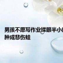 男孩不愿写作业揉眼半小时 双眼肿成悲伤蛙