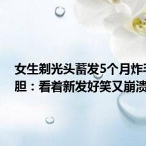 女生剃光头蓄发5个月炸毛似海胆:看着新发好笑又崩溃