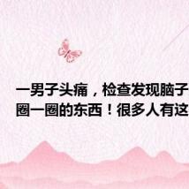 一男子头痛,检查发现脑子里有一圈一圈的东西!很多人有这习惯…