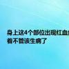 身上这4个部位出现红血丝，拖着不管该生病了