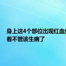 身上这4个部位出现红血丝，拖着不管该生病了