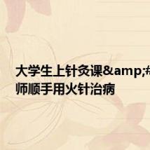 大学生上针灸课&#32;老师顺手用火针治病