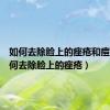 如何去除脸上的痤疮和痘印（如何去除脸上的痤疮）