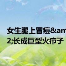 女生腿上冒痘&#32;长成巨型火疖子