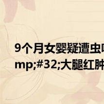 9个月女婴疑遭虫咬 大腿红肿