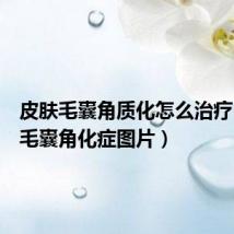 皮肤毛囊角质化怎么治疗(皮肤毛囊角化症图片)