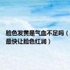 脸色发黄是气血不足吗（吃什么最快让脸色红润）