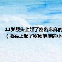 11岁额头上起了密密麻麻的小疙瘩(额头上起了密密麻麻的小疙瘩)