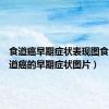 食道癌早期症状表现图食道（食道癌的早期症状图片）