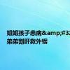 姐姐孩子患病&#32;28岁弟弟割肝救外甥