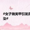 #女子做美甲引发真菌感染#