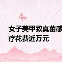 女子美甲致真菌感染治疗花费近万元