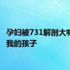 孕妇被731解剖大喊放过我的孩子