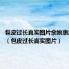 包皮过长真实图片余姚惠民.简介（包皮过长真实图片）