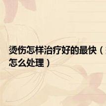 烫伤怎样治疗好的最快(烫伤后怎么处理)