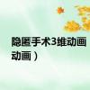 隐匿手术3维动画（3维动画）