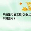 尸斑图片 真实照片5到10小时（尸斑图片）