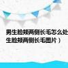 男生脸颊两侧长毛怎么处理（男生脸颊两侧长毛图片）
